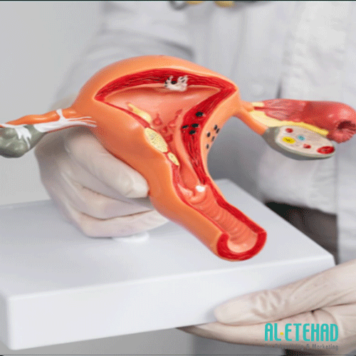 Medical anatomical model of the uterus