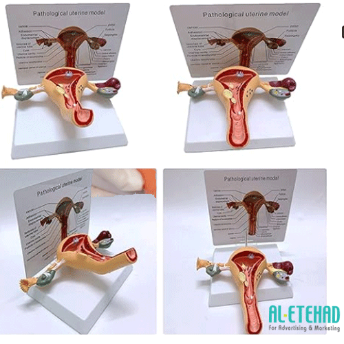 Medical anatomical model of the uterus